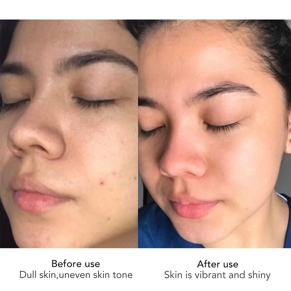 AILKE Skin Radiant Facial Cream Sodium Hyaluronate Brightening Moisturizing