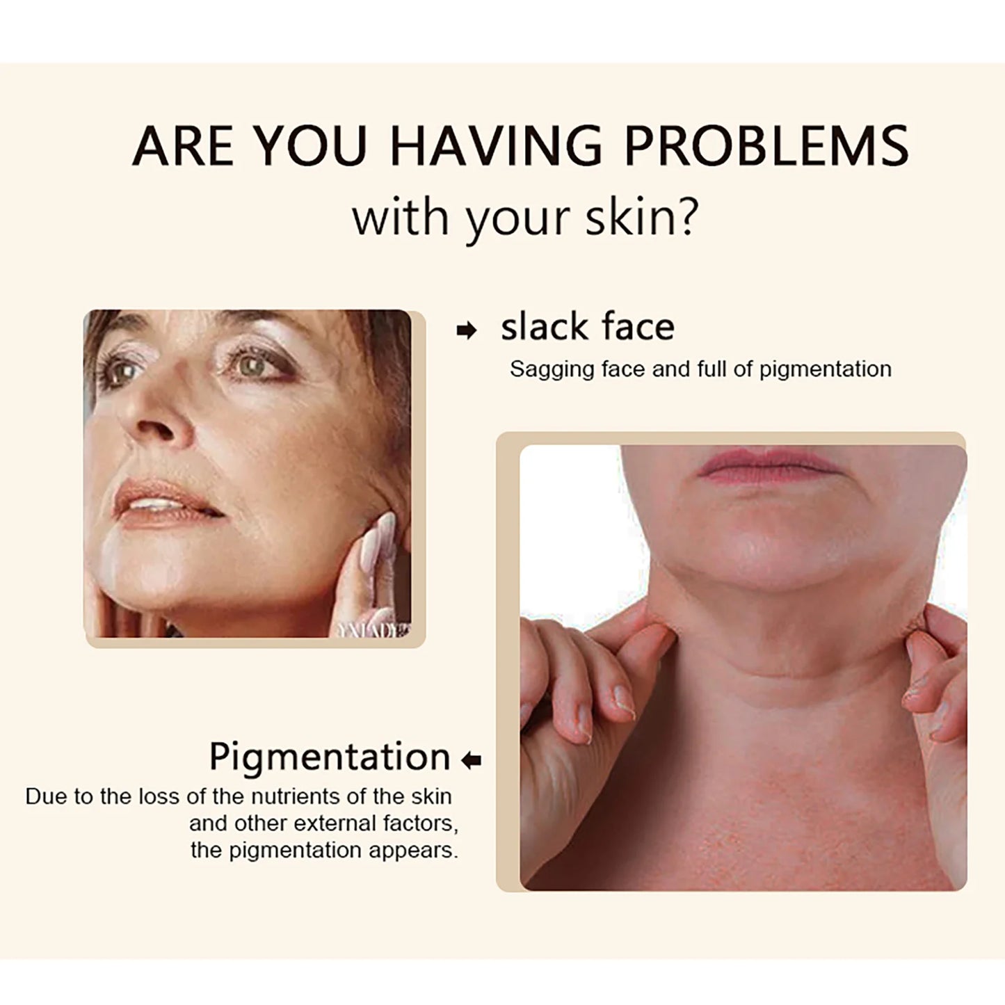 Kyliefit Collagen Whitening Cream for Skin Brightening and Even Tone