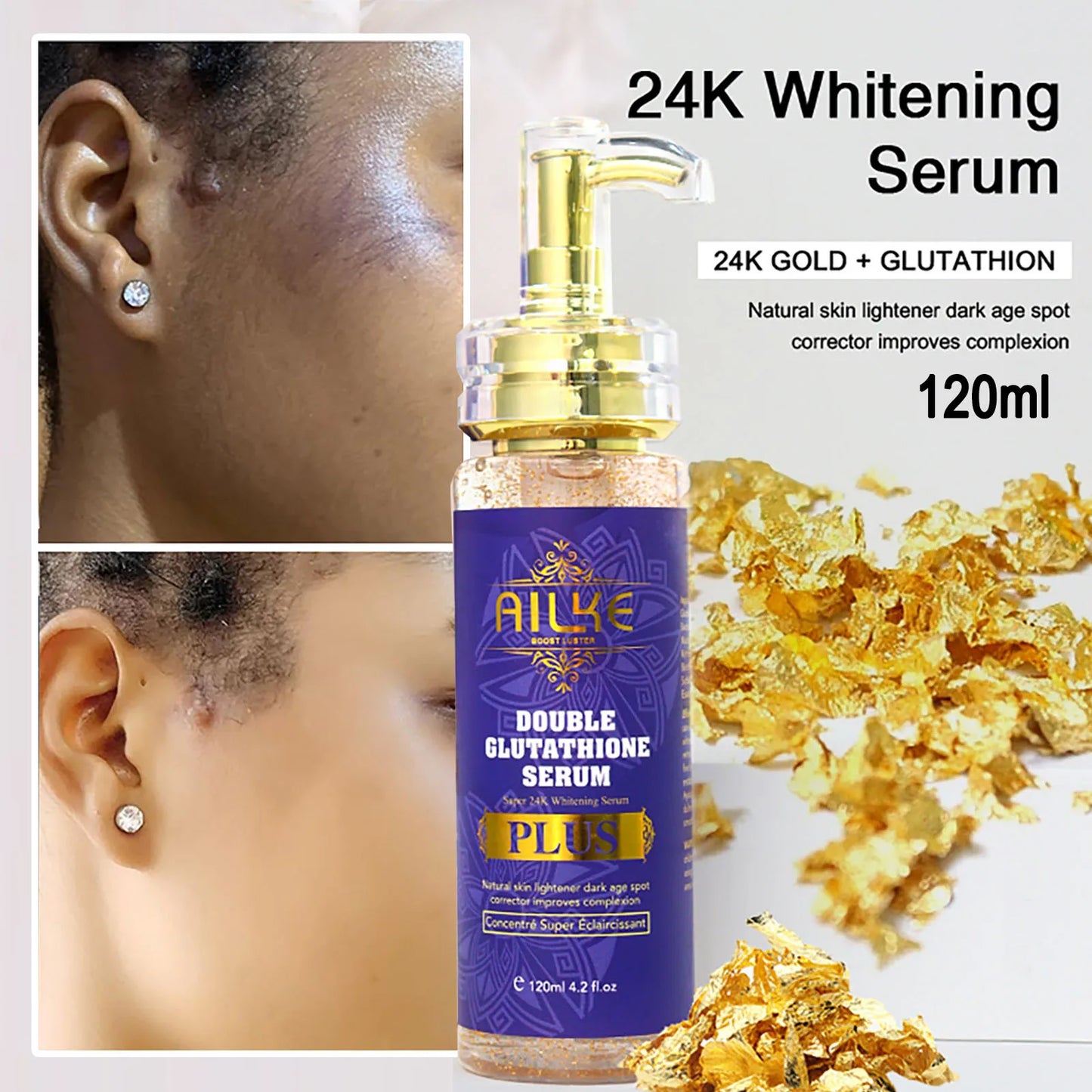 AILKE Whitening Lotion and Serum for Dark Spot Reduction